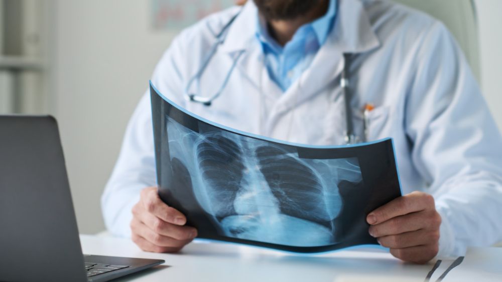 Doctor reviewing chest X-ray or CT scan